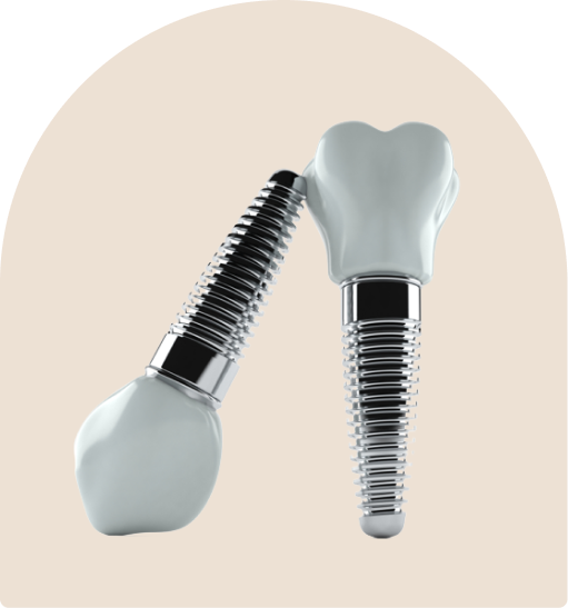 Dental implants